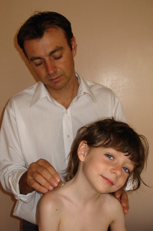 Acupuncture treatment