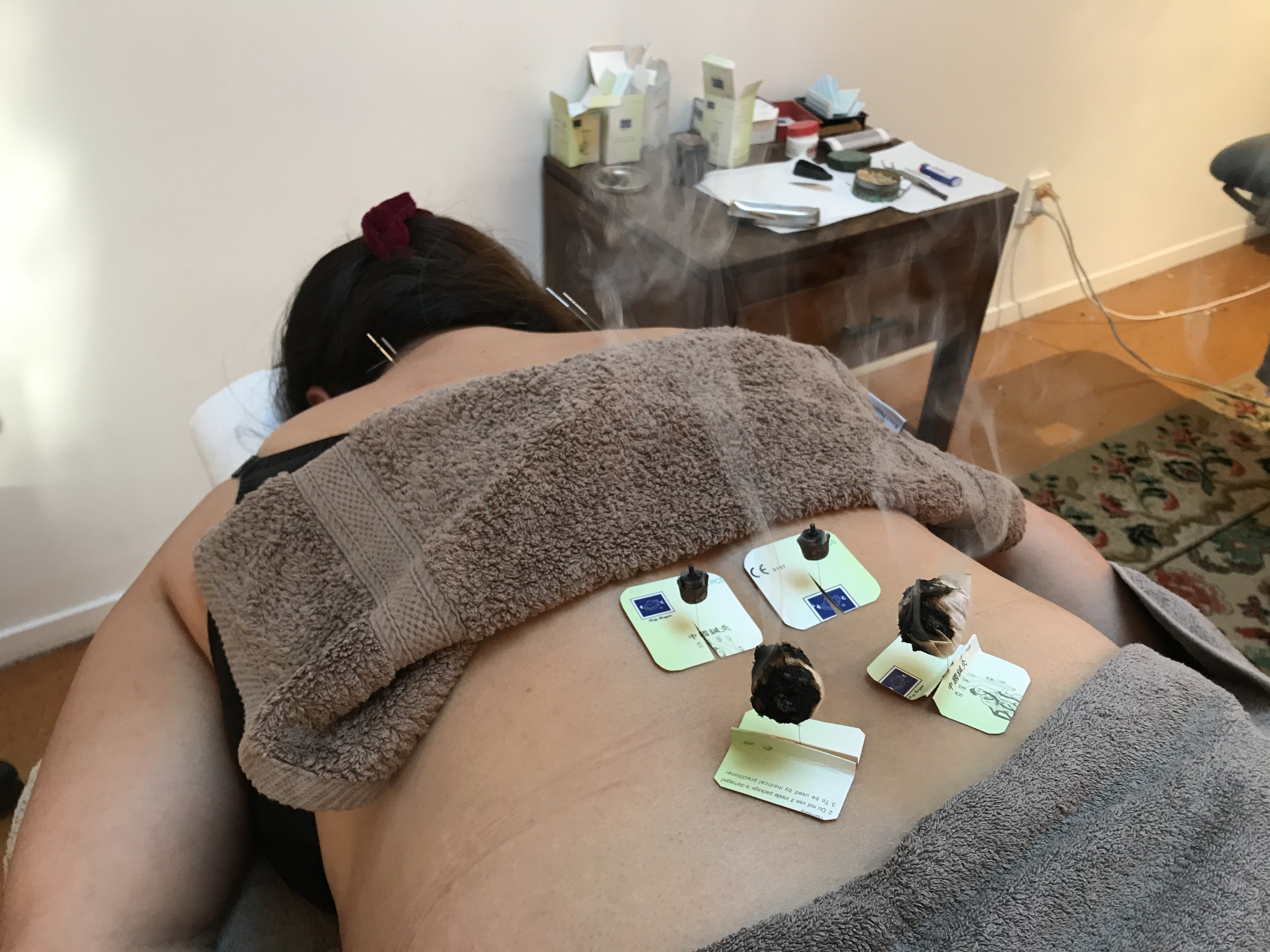 Moxibustion